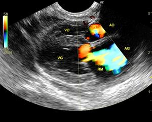 Clinique vétérinaire Les Angles, échographie cardiaque